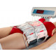 Аппарат холодного лазерного липолиза Lipobeltlaser